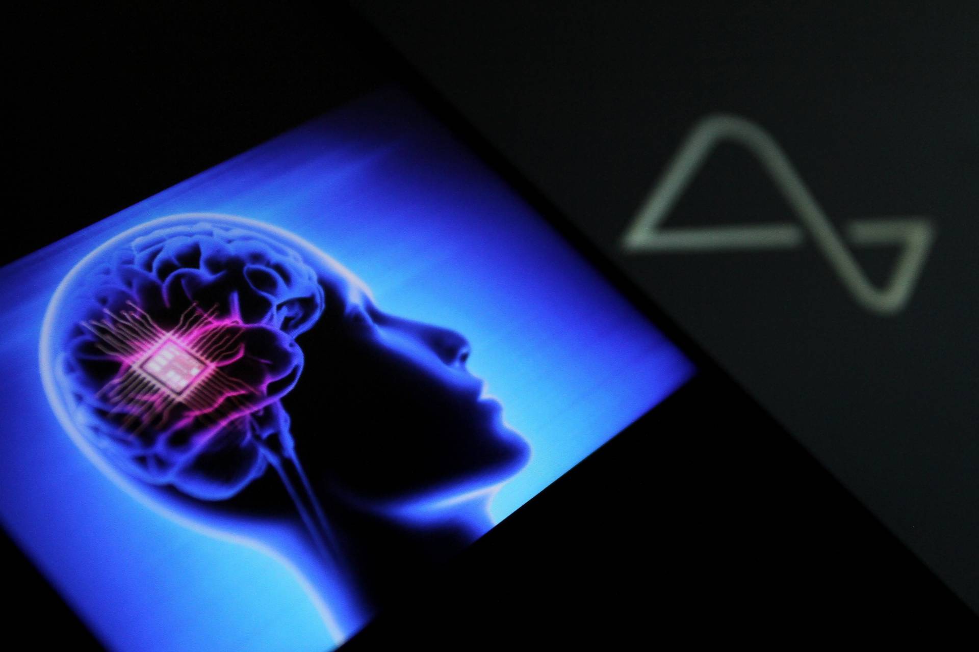 Neurotechnologie (-e)